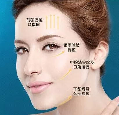 面部提升新技术揭秘，科技魔法助力笑容重现