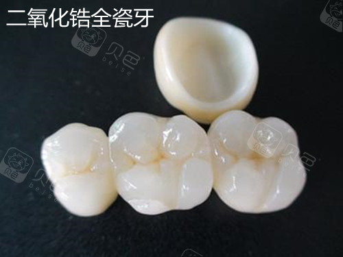 二氧化锆全瓷牙价格表